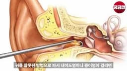 귀지를 파지 않으면 생기는 문제